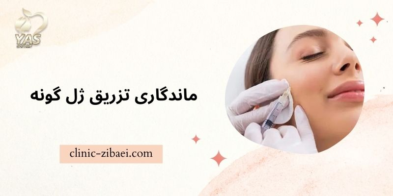 تزریق ژل گونه چقدر ماندگاری دارد؟ - کلینیک زیبایی