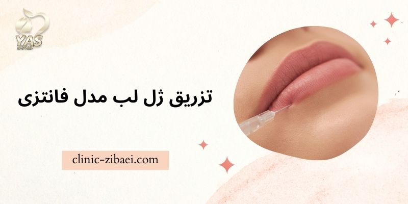 تزریق ژل لب مدل فانتزی در کلینیک زیبایی با به روز ترین روش های دنیا