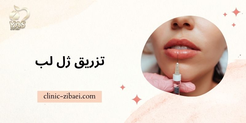 تزریق ژل لب طبیعی در کلینیک زیبایی