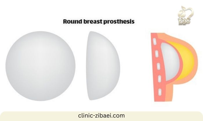 انواع پروتز سینه مدل گرد در کلینیک زیبایی 