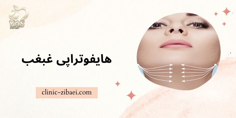 هایفوتراپی غبغب در کلینیک زیبایی