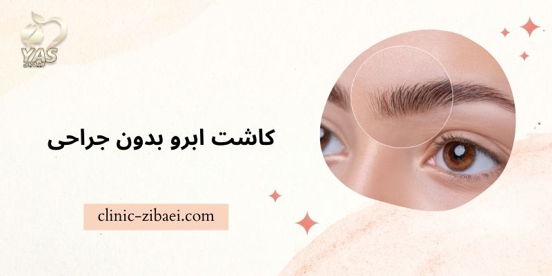 کاشت ابرو بدون جراحی چگونه است؟ در کلینیک زیبایی