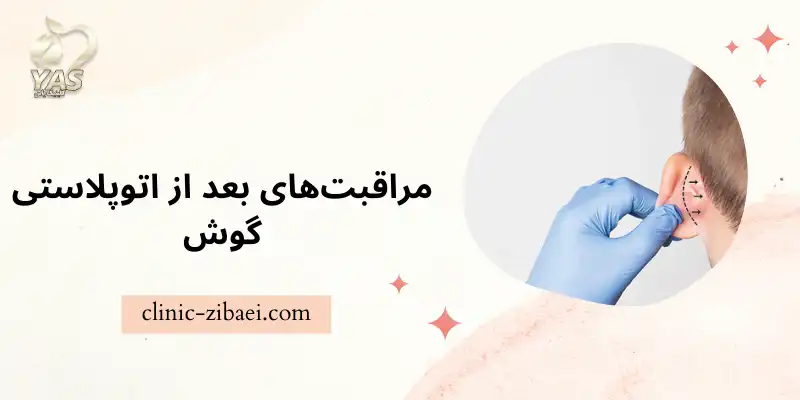 مراقبت‌های بعد از اتوپلاستی گوش