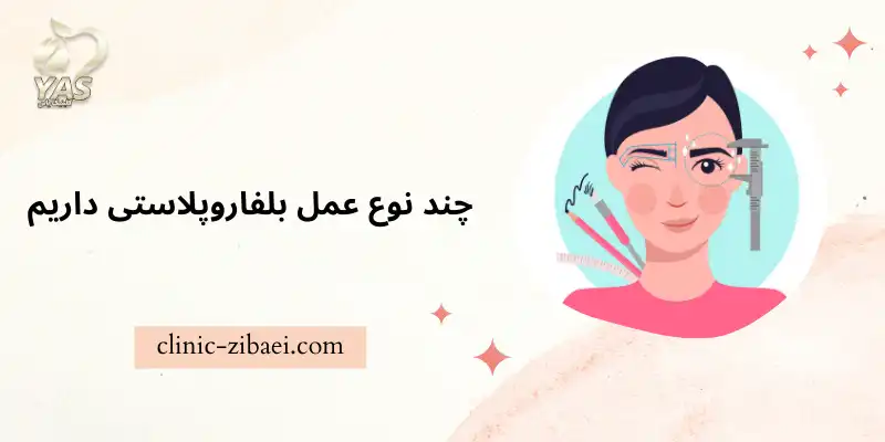 چند نوع عمل بلفاروپلاستی داریم