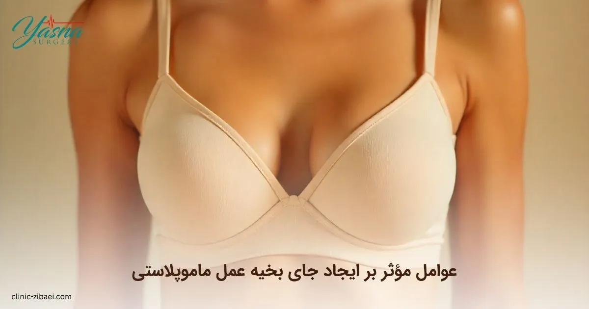 عوامل مؤثر بر ایجاد جای بخیه عمل ماموپلاستی