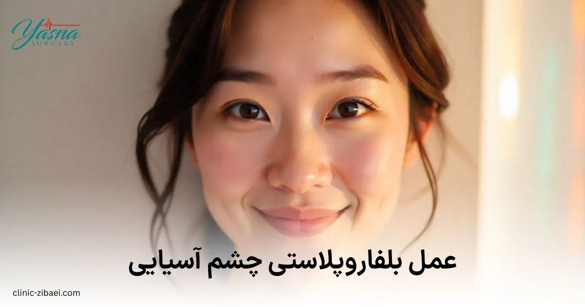 عمل بلفاروپلاستی چشم آسیایی