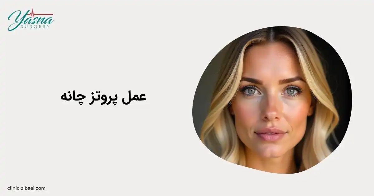 عمل پروتز چانه