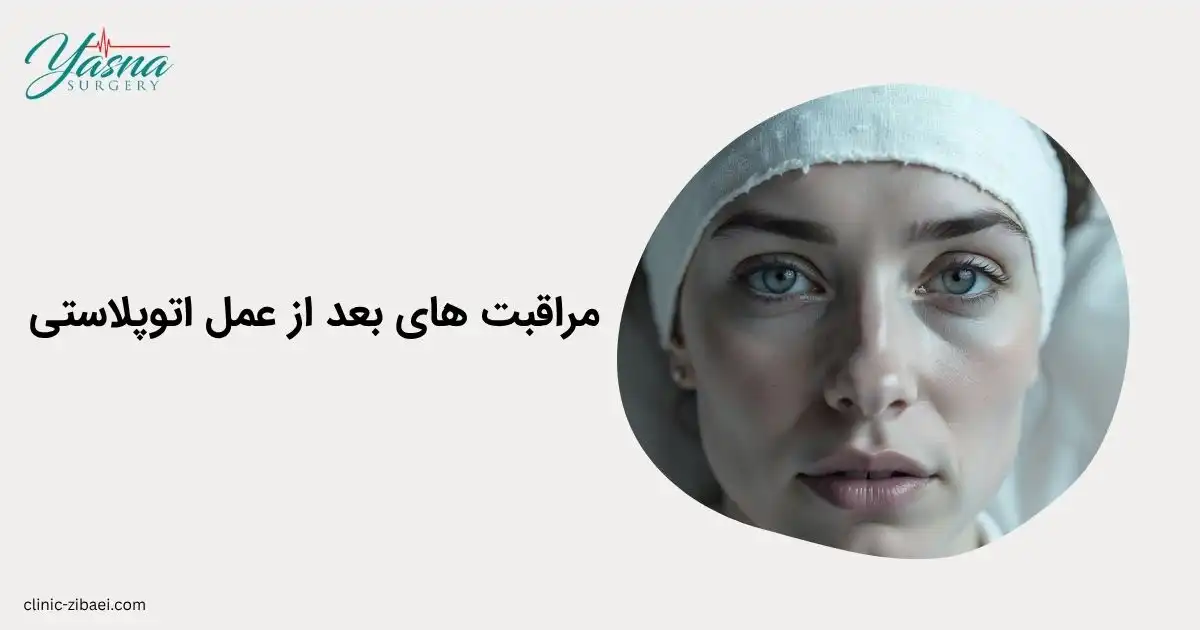 مراقبت های بعد از عمل اتوپلاستی گوش