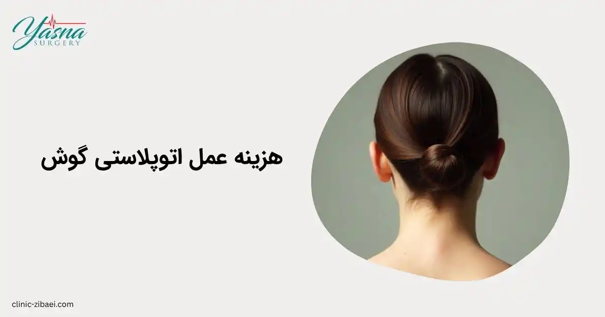 هزینه عمل اتوپلاستی گوش