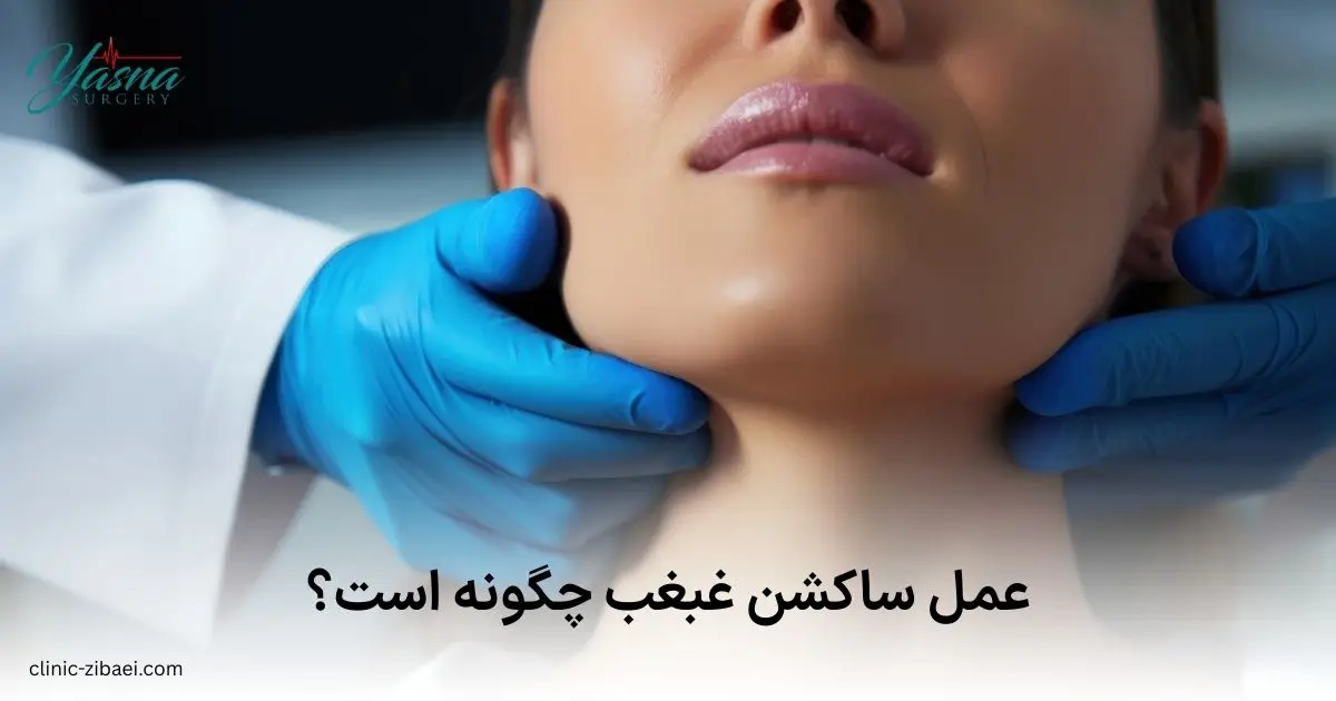 عمل ساکشن غبغب چگونه است