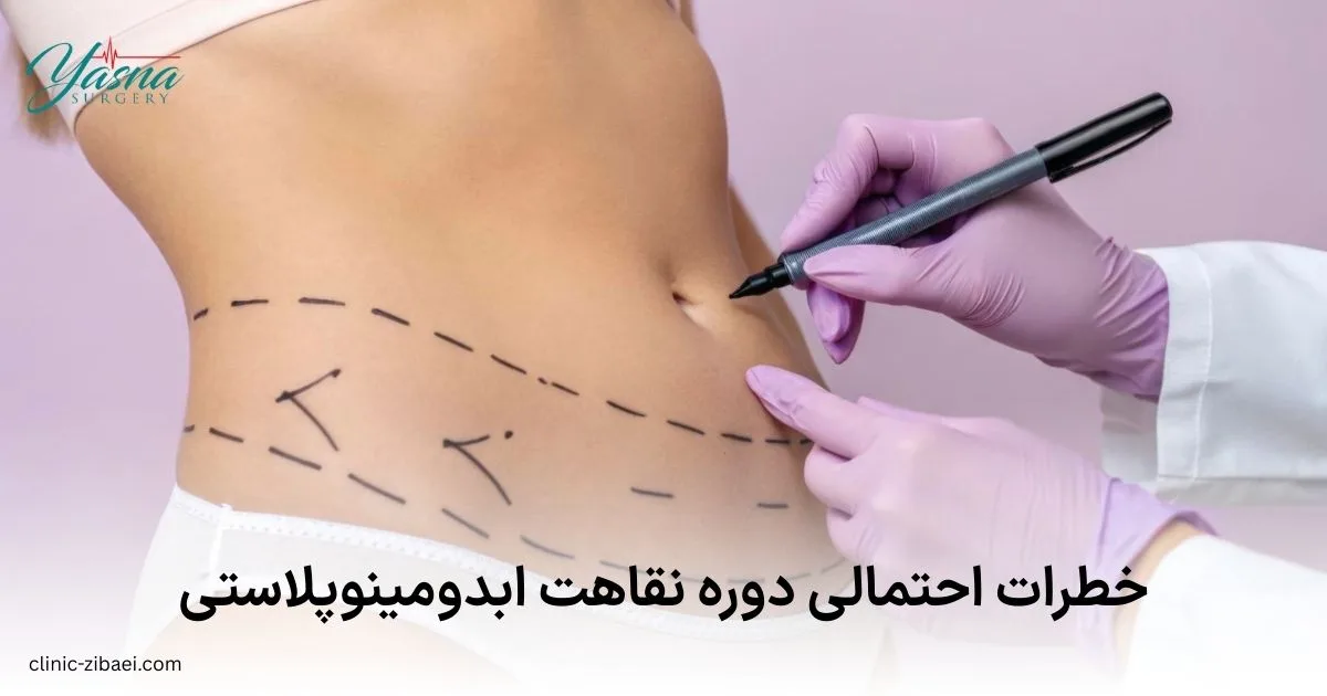 خطرات احتمالی دوره نقاهت ابدومینوپلاستی