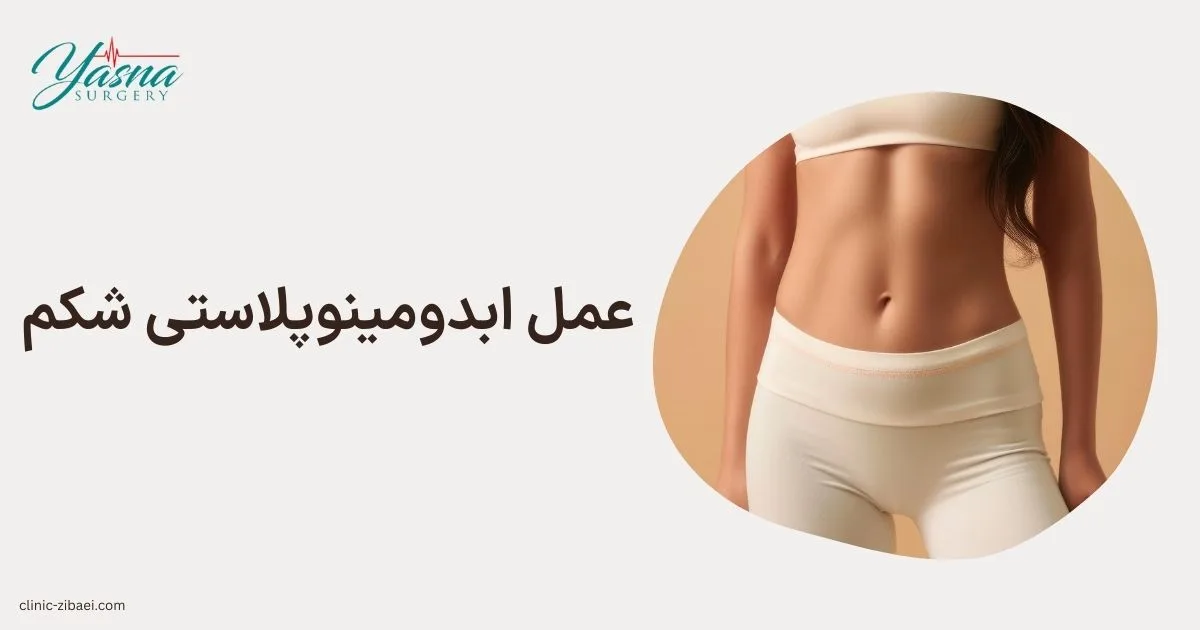 عمل ابدومینوپلاستی شکم