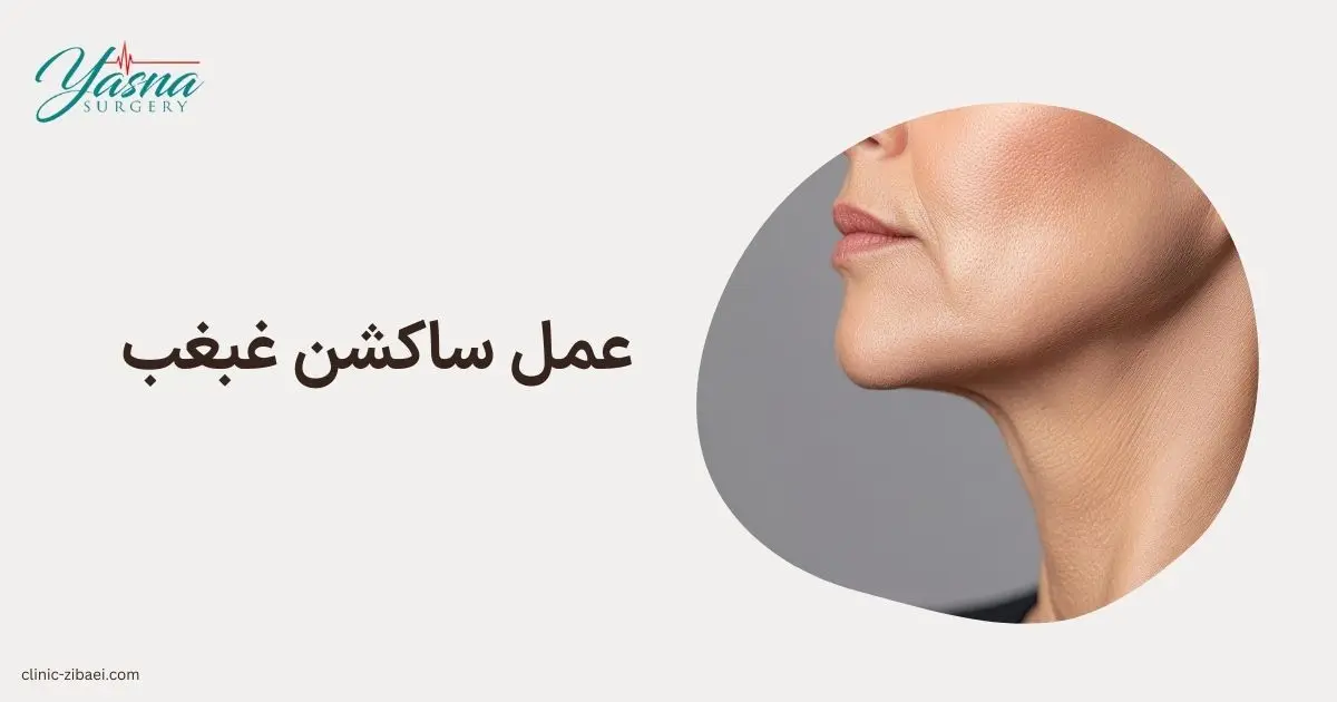 عمل ساکشن غبغب