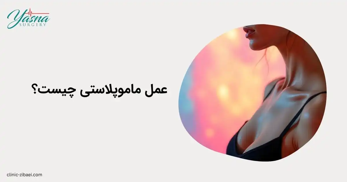 عمل ماموپلاستی