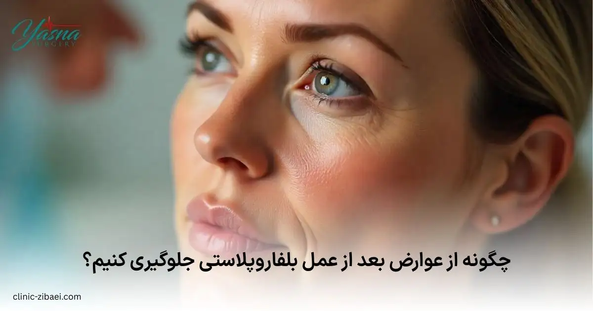 چگونه از عوارض بعد از عمل بلفاروپلاستی جلوگیری کنیم