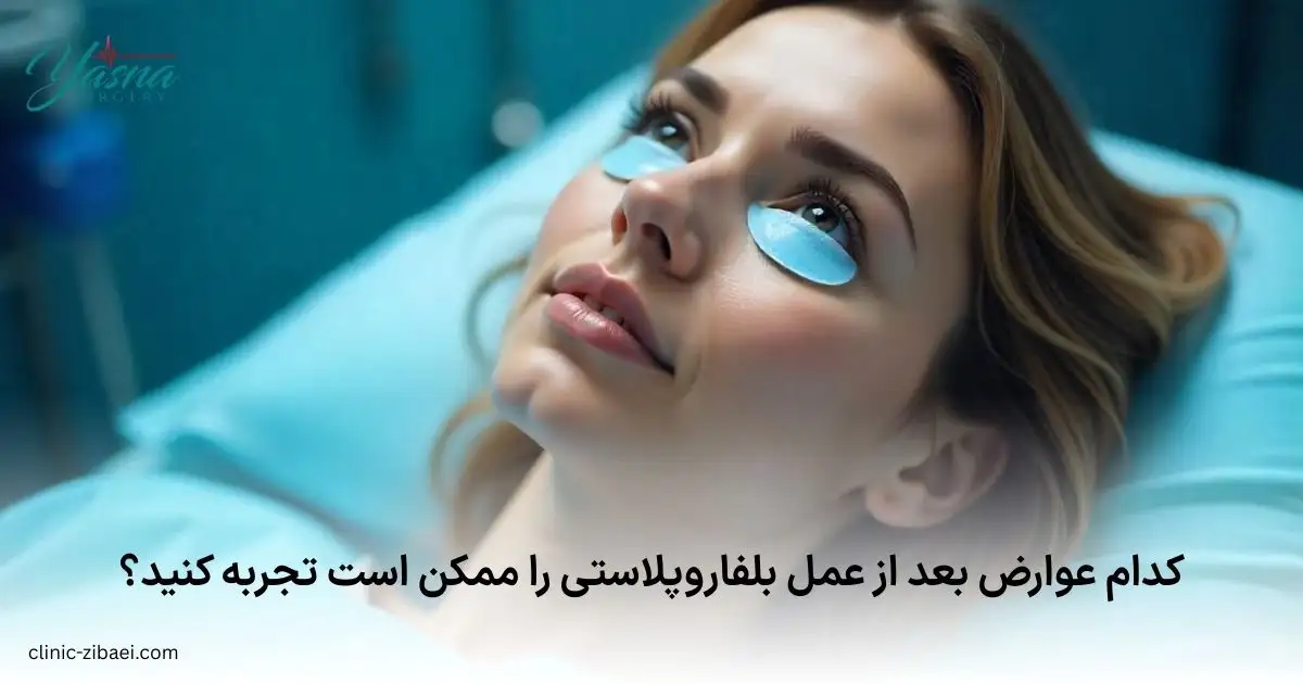 کدام عوارض بعد از عمل بلفاروپلاستی را ممکن است تجربه کنید؟