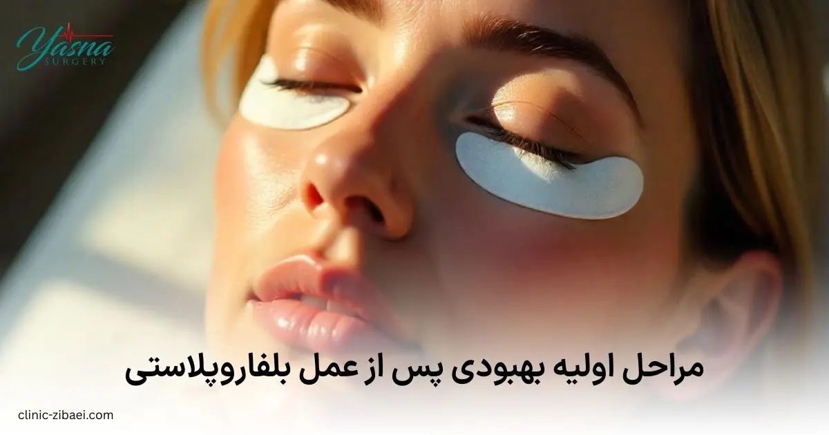 مراحل اولیه بهبودی پس از عمل بلفاروپلاستی
