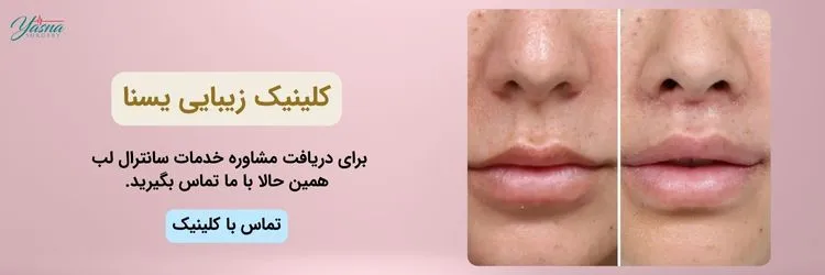 مشاوره خدمات سانترال لب