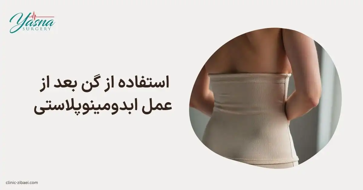 استفاده از گن بعد از عمل ابدومینوپلاستی