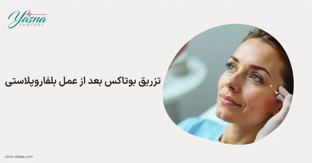 تزریق بوتاکس بعد از عمل بلفاروپلاستی