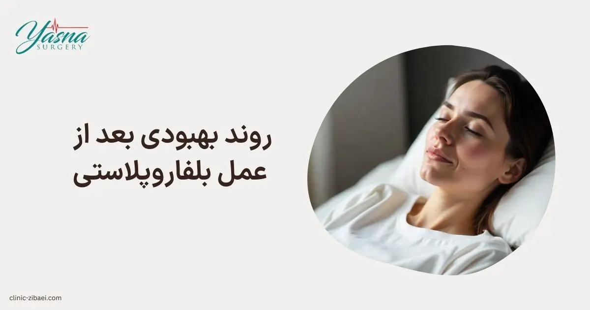 روند بهبودی بعد از عمل بلفاروپلاستی