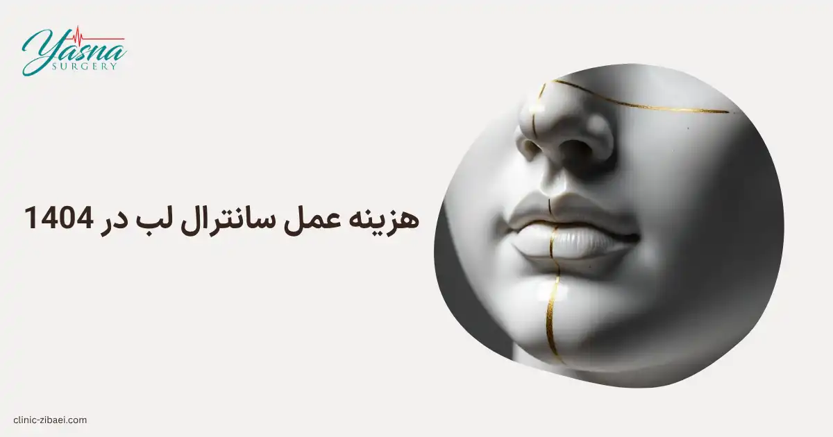 هزینه عمل سانترال لب