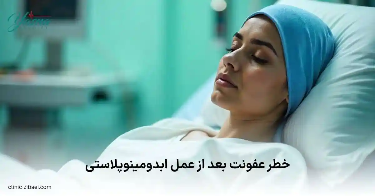 خطر عفونت بعد از عمل ابدومینوپلاستی