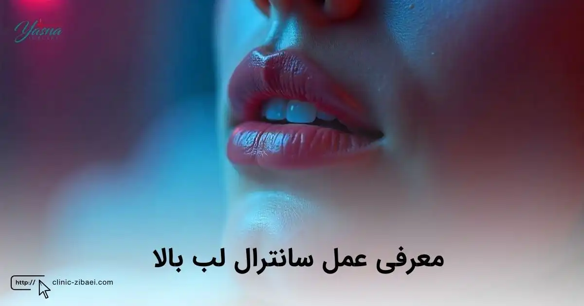 معرفی عمل سانترال لب بالا