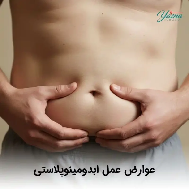 عوارض عمل ابدومینوپلاستی