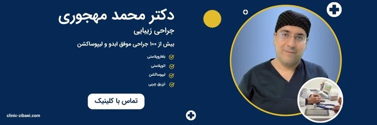مشاوره تماس