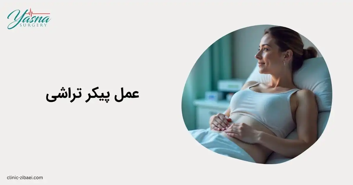 عمل پیکر تراشی