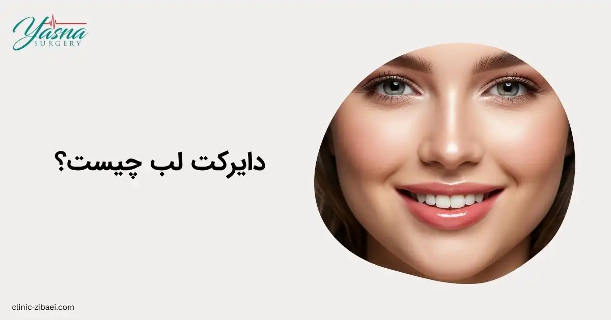 دایرکت لب چیست