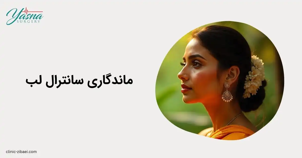 ماندگاری سانترال لب