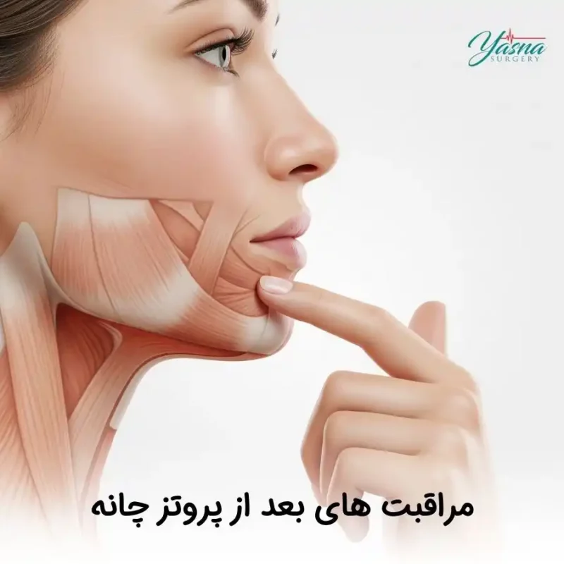 مراقبت های بعد از پروتز چانه