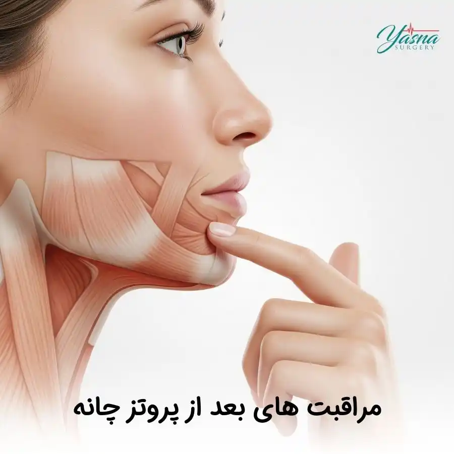 مراقبت های بعد از پروتز چانه