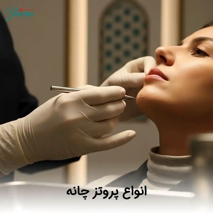 انواع پروتز چانه