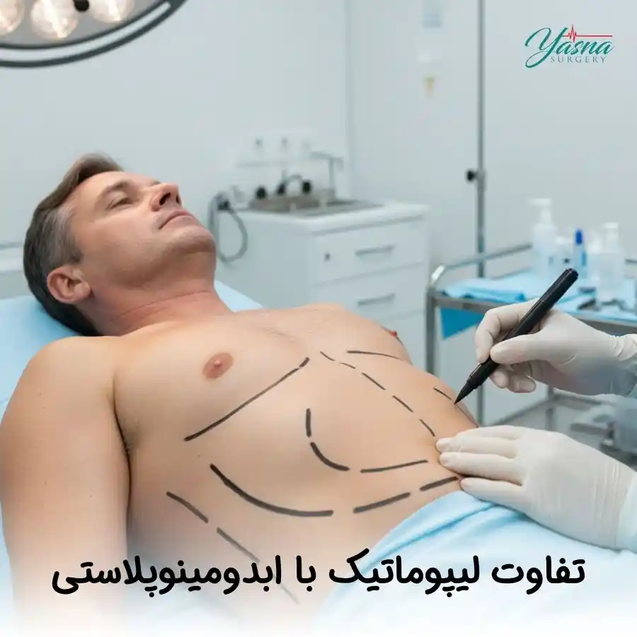 تفاوت لیپوماتیک با ابدومینوپلاستی